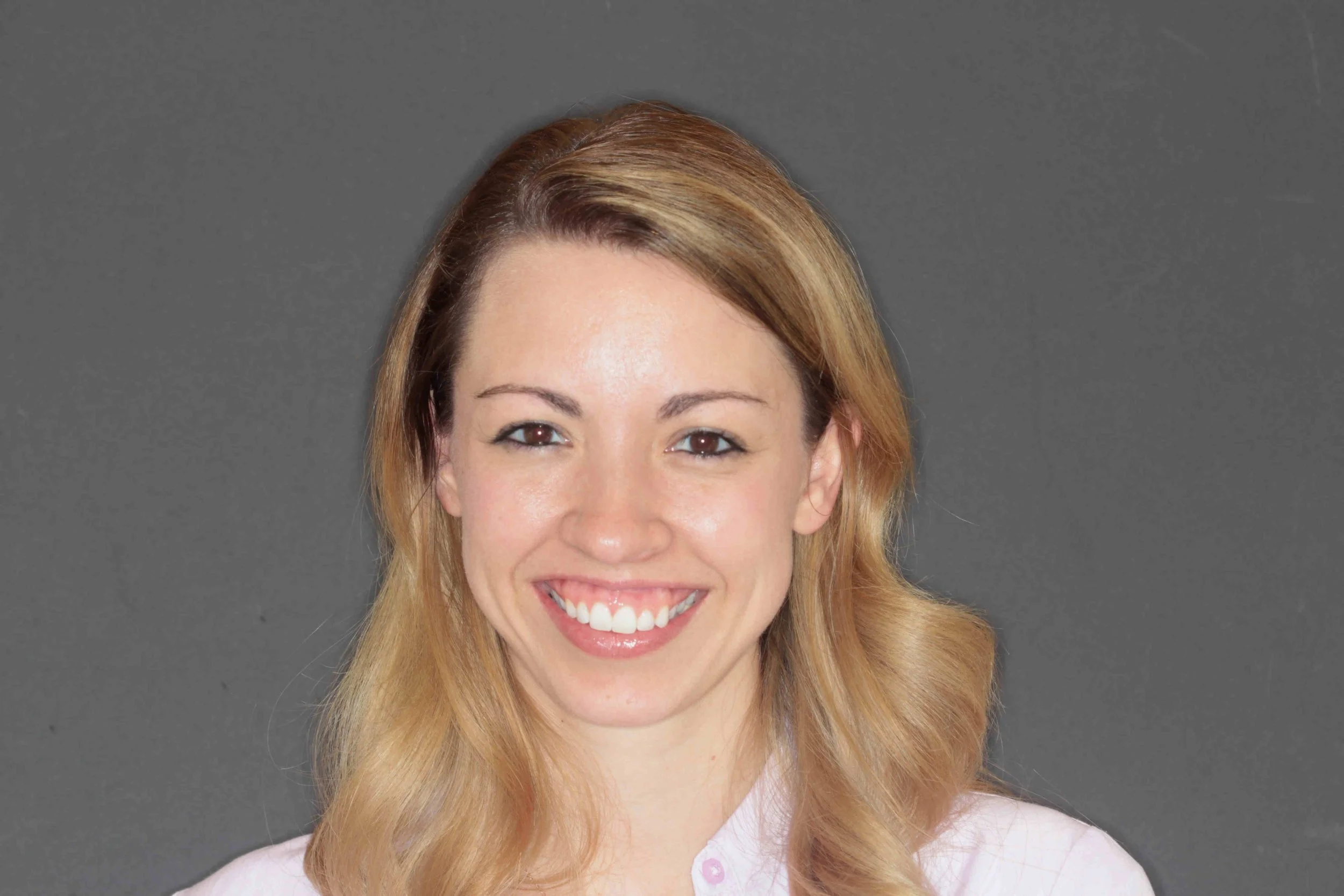 Before: portrait of the patient smiling, showing gum tissue above the upper teeth.